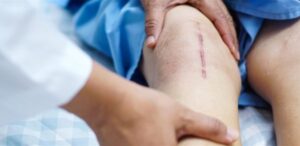 استخدام الفيروسات لعلاج الجروح الخطيرة