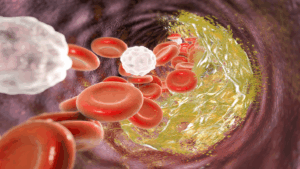 تخفيض نسبة الكوليسترول