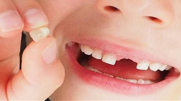 سقوط الأسنان الأمامية.. رسالة بين البشارة والتحذير