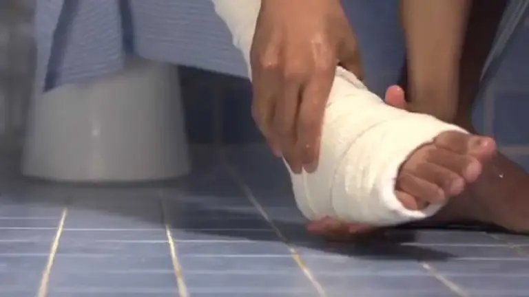 رأي الإمام أحمد بن حنبل في المسح على الجبيرة وضوابطه الفقهية